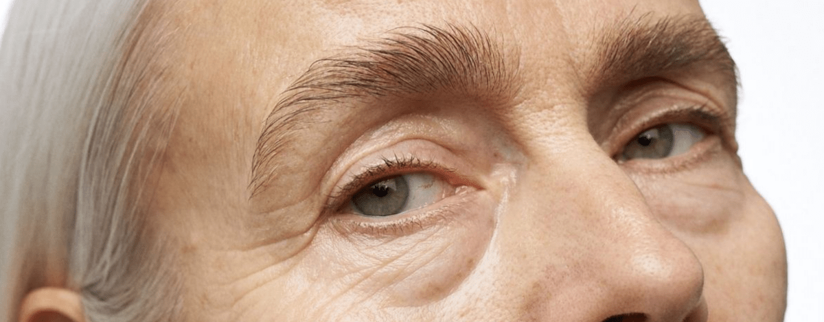 ¿Por Qué Se Caen Las Pestañas Durante La Menopausia? Causas y Consejos - UKLASH España
