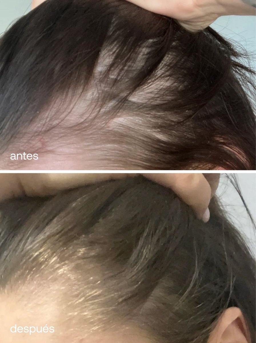 Champú para el Cabello - UKLASH España