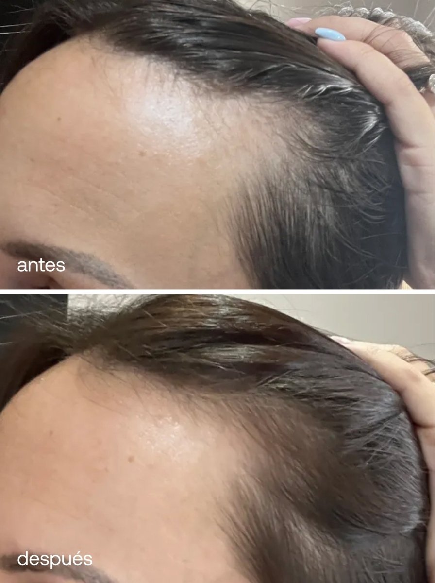 Sérum de Crecimiento del Cabello - UKLASH España