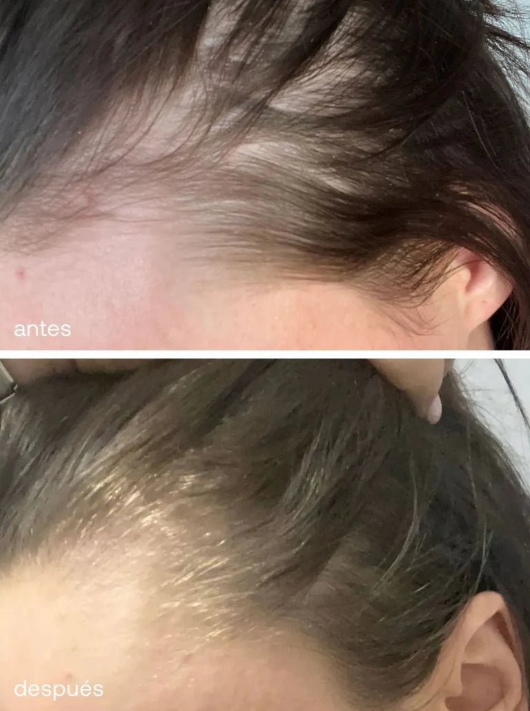 Sérum de Crecimiento del Cabello - UKLASH España