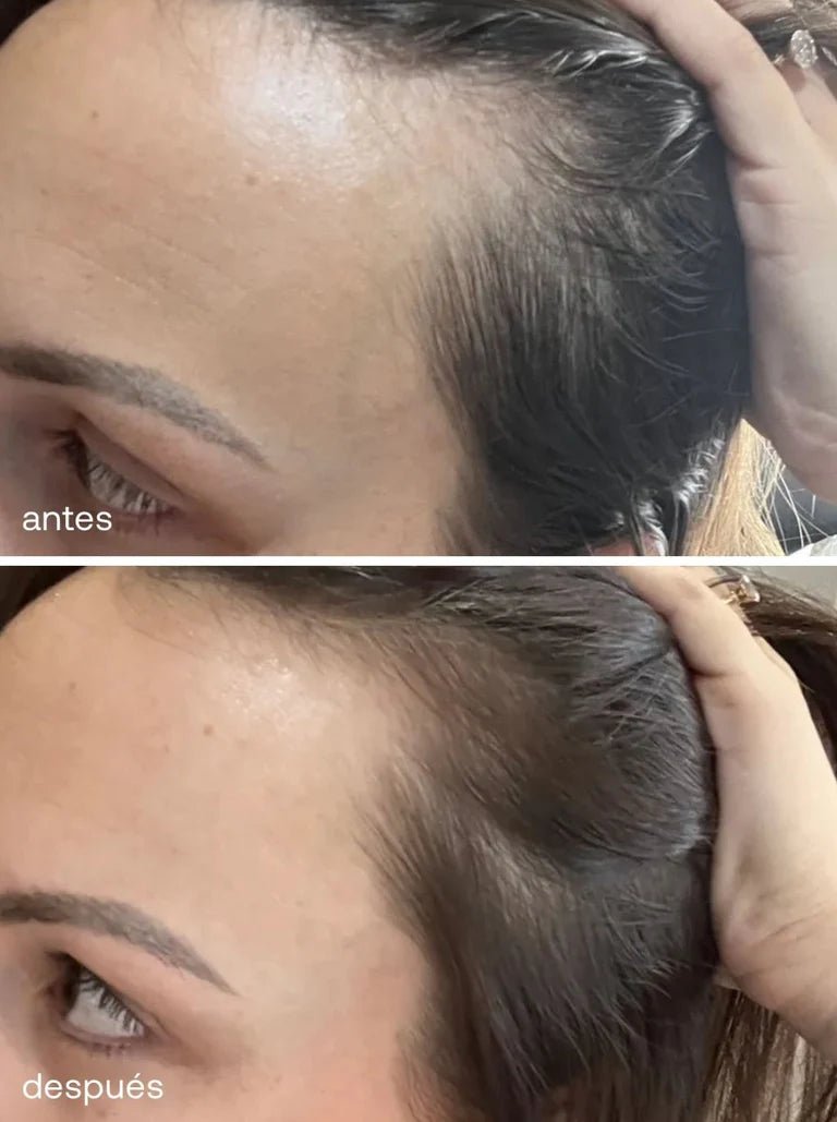 Sérum de Crecimiento del Cabello - UKLASH España