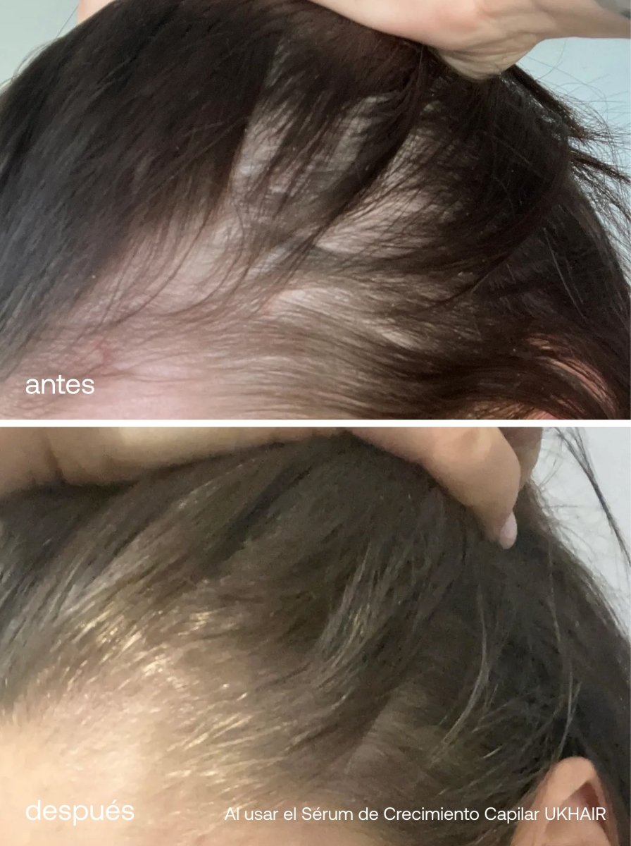 Set Básico para el Crecimiento del Cabello - UKLASH España