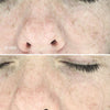 Máscara Facial LED Dual Light Pro-Therapy