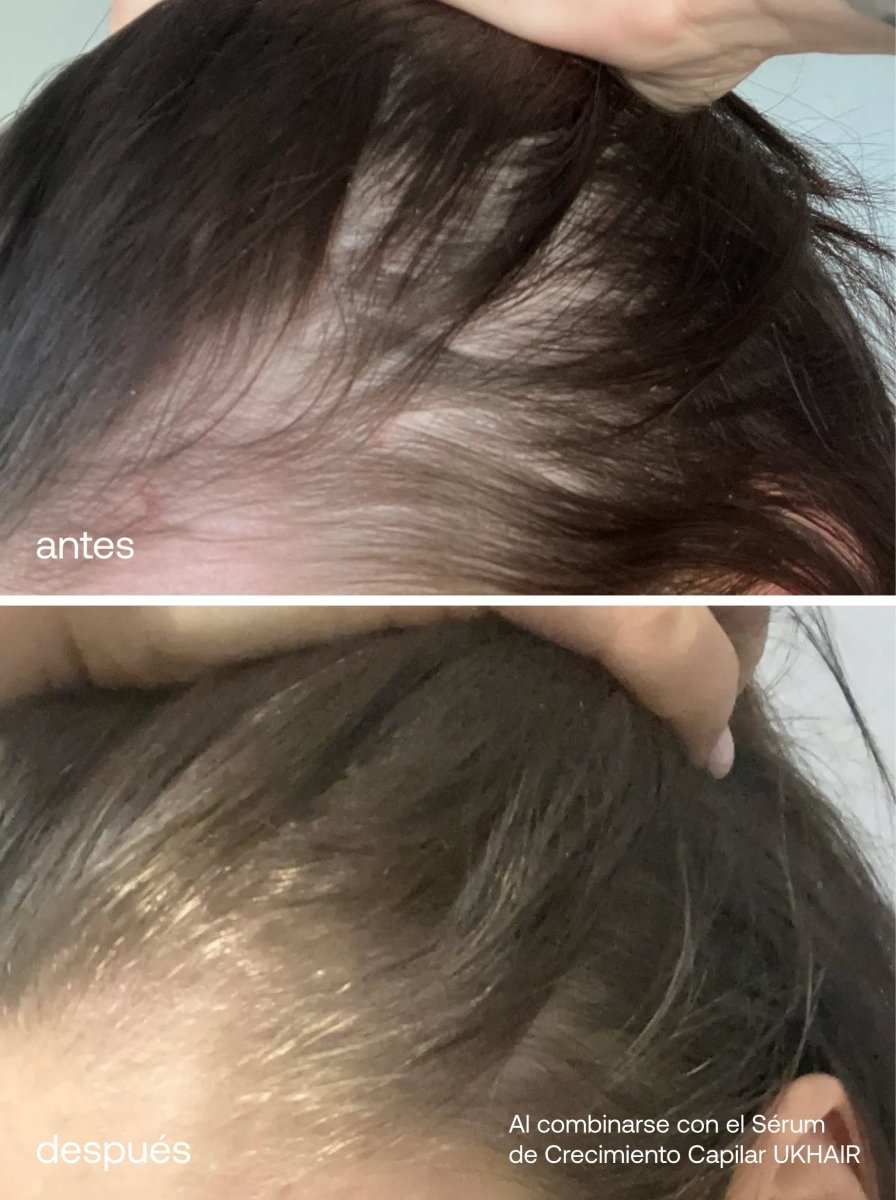 Esenciales para el Cuidado del Cabello - UKLASH España