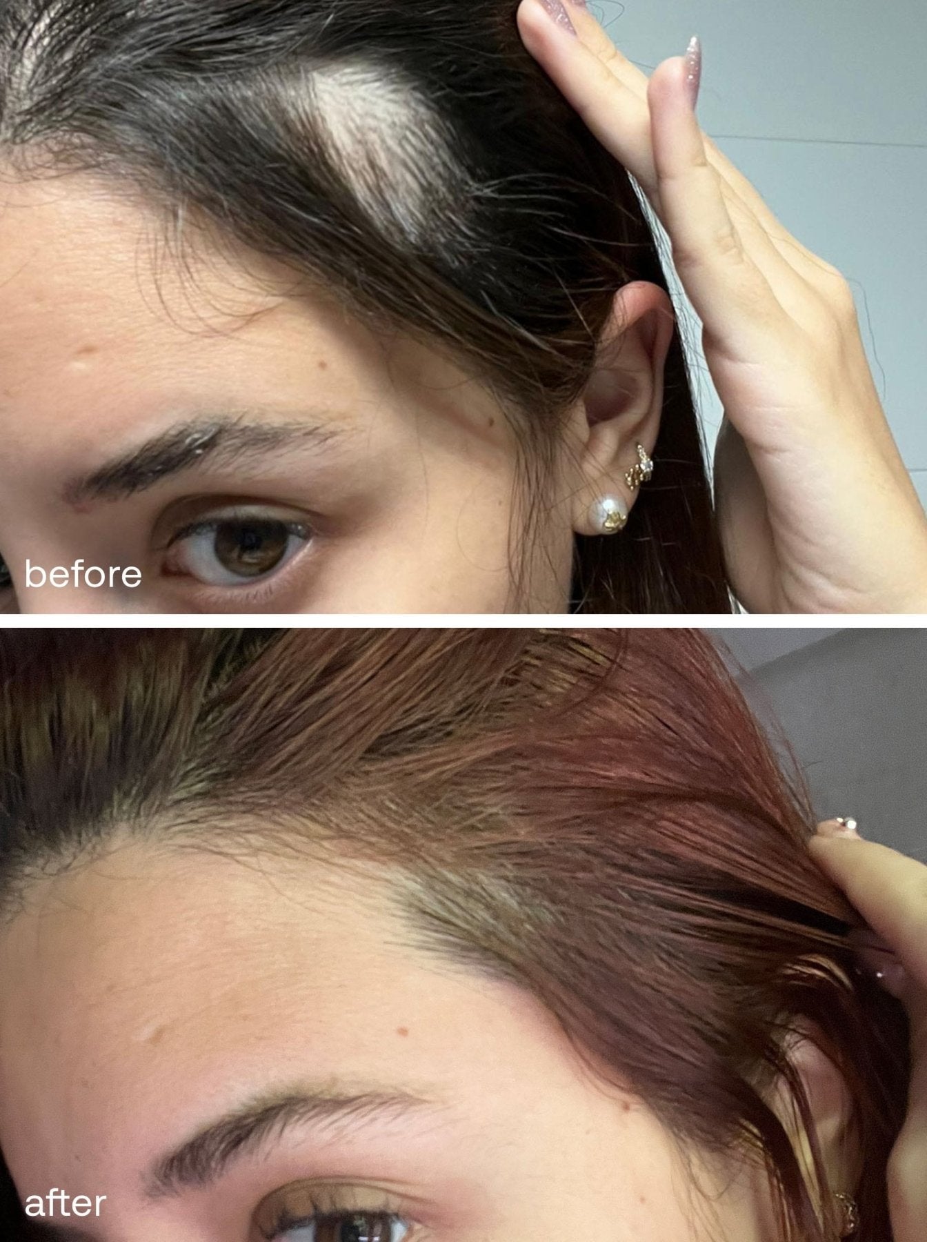 Hair Growth Serum - UKLASH