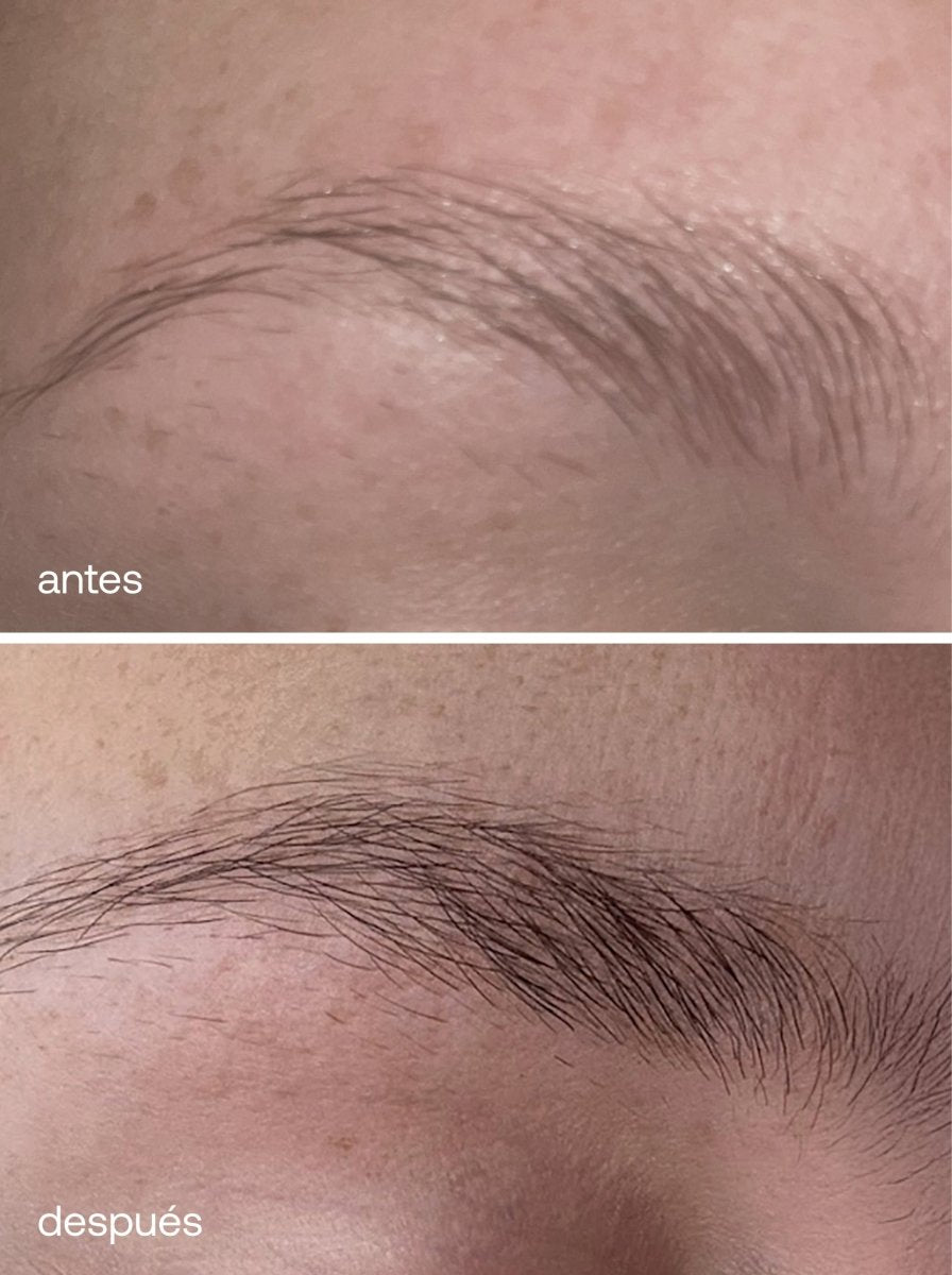 Kit De Crecimiento Para Pestañas Y Cejas - UKLASH España