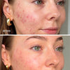 Máscara Facial LED Dual Light Pro-Therapy - UKLASH España