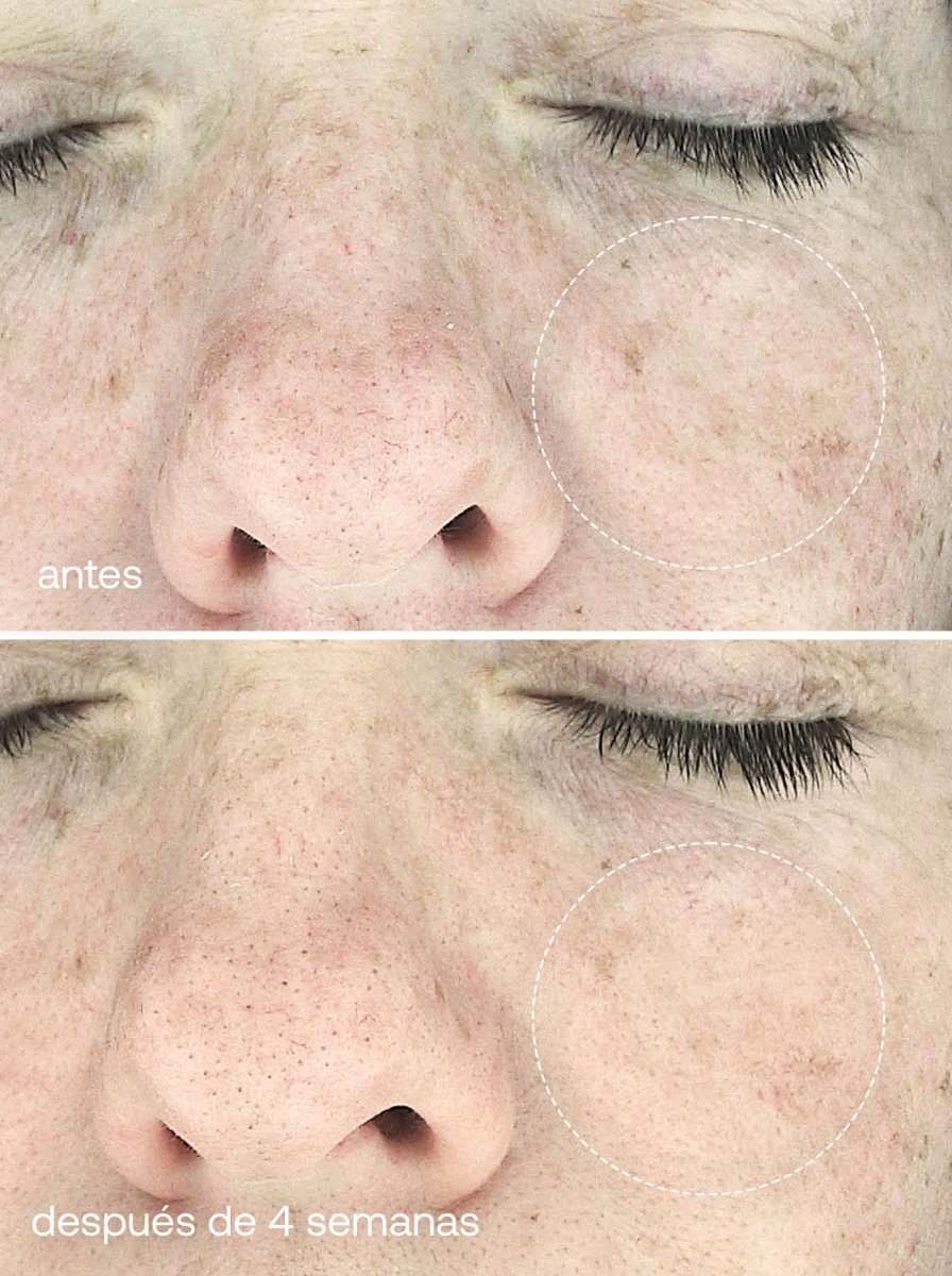 Máscara Facial LED Dual Light Pro - Therapy - UKLASH España