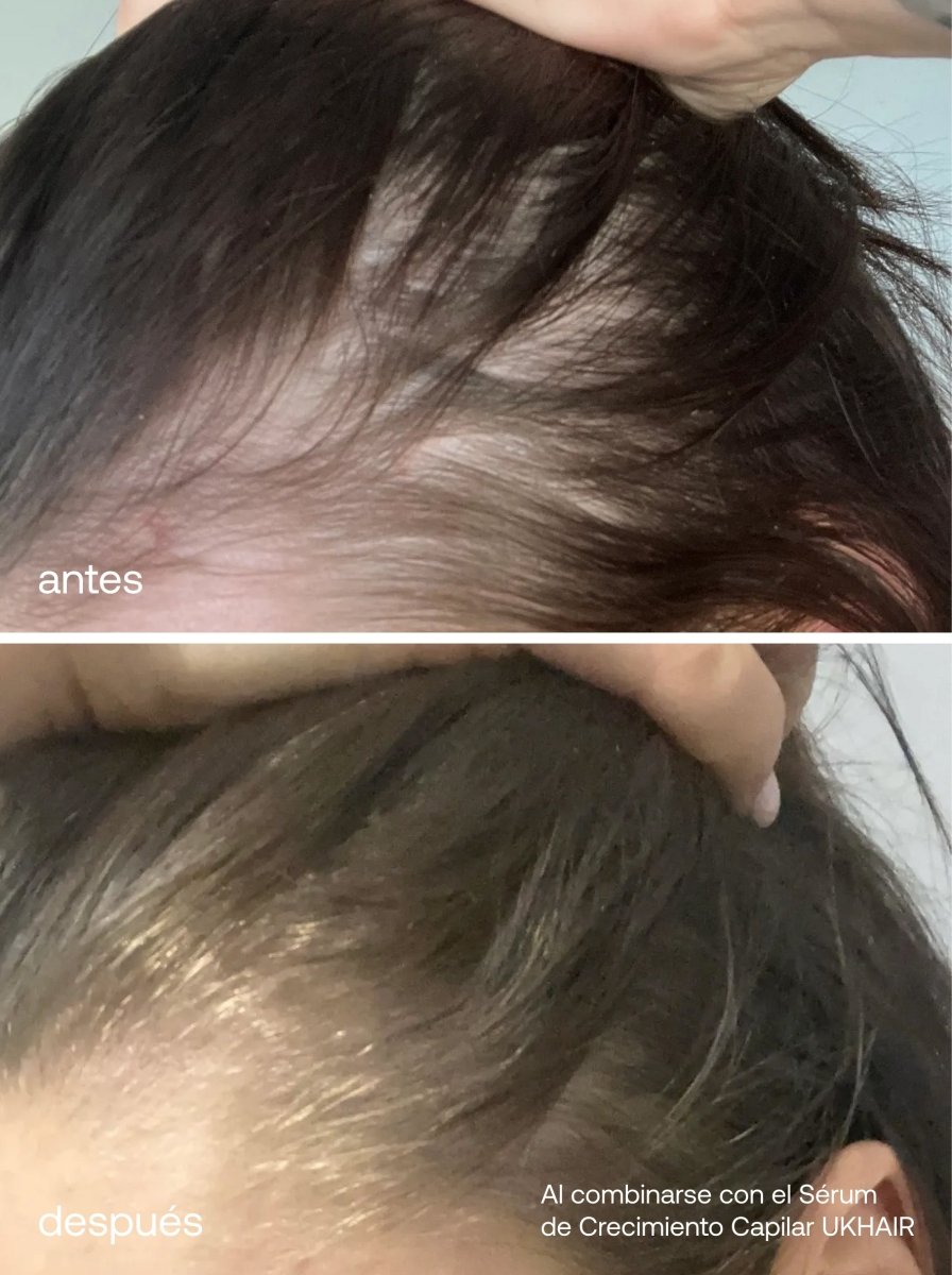 Mini Esenciales para el Cuidado del Cabello - UKLASH España