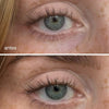 Sérum Contorno de Ojos con Vitamina C + Ácido Hialurónico - UKLASH España