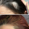 Sérum de Crecimiento del Cabello + Suplementos Capilares Avanzados + Advanced Scalp Dermaroller - UKLASH España