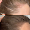 Sérum de Crecimiento del Cabello + Suplementos Capilares Avanzados + Advanced Scalp Dermaroller - UKLASH España