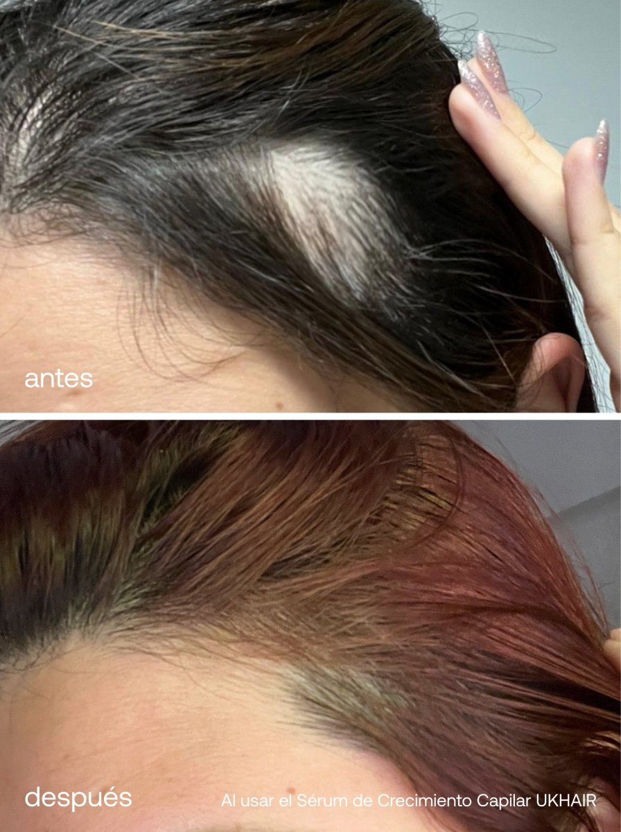 Sérum de Crecimiento del Cabello + Suplementos Capilares Avanzados - UKLASH España