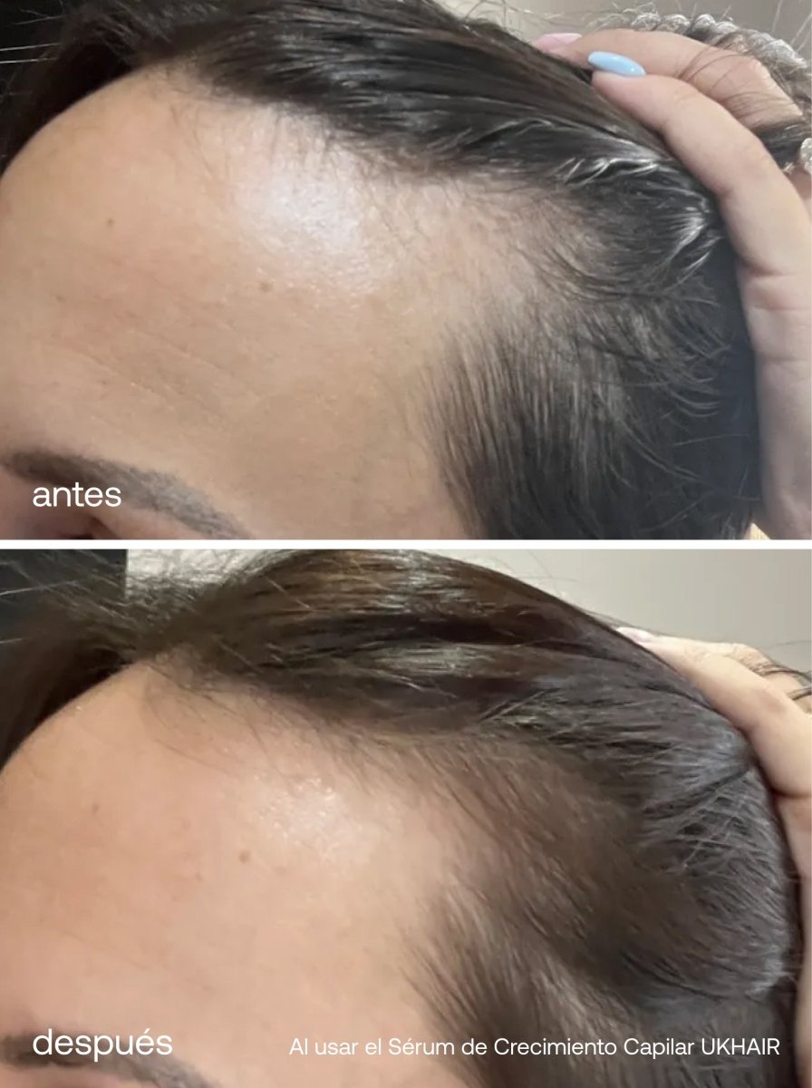 Set de Sérums para Pestañas y Cabello - Complex - UKLASH España