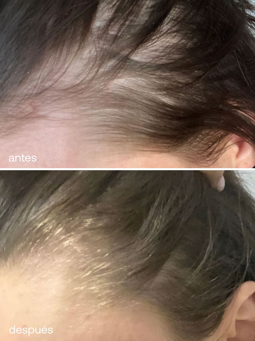 Set Reparador y de Crecimiento del Cabello - UKLASH España