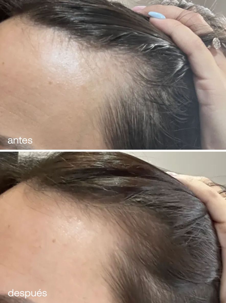 Set Reparador y de Crecimiento del Cabello - UKLASH España