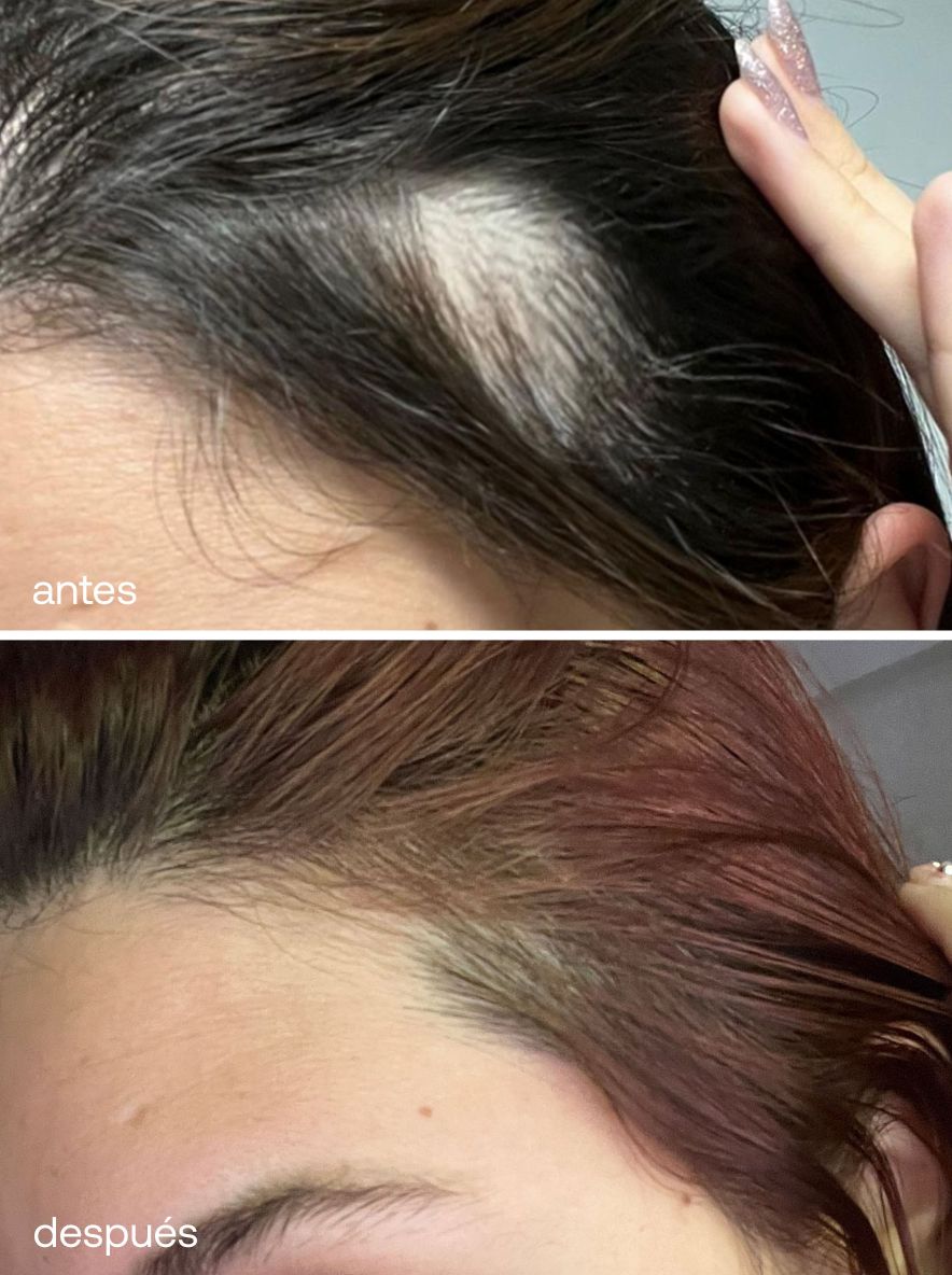 Set Reparador y de Crecimiento del Cabello - UKLASH España