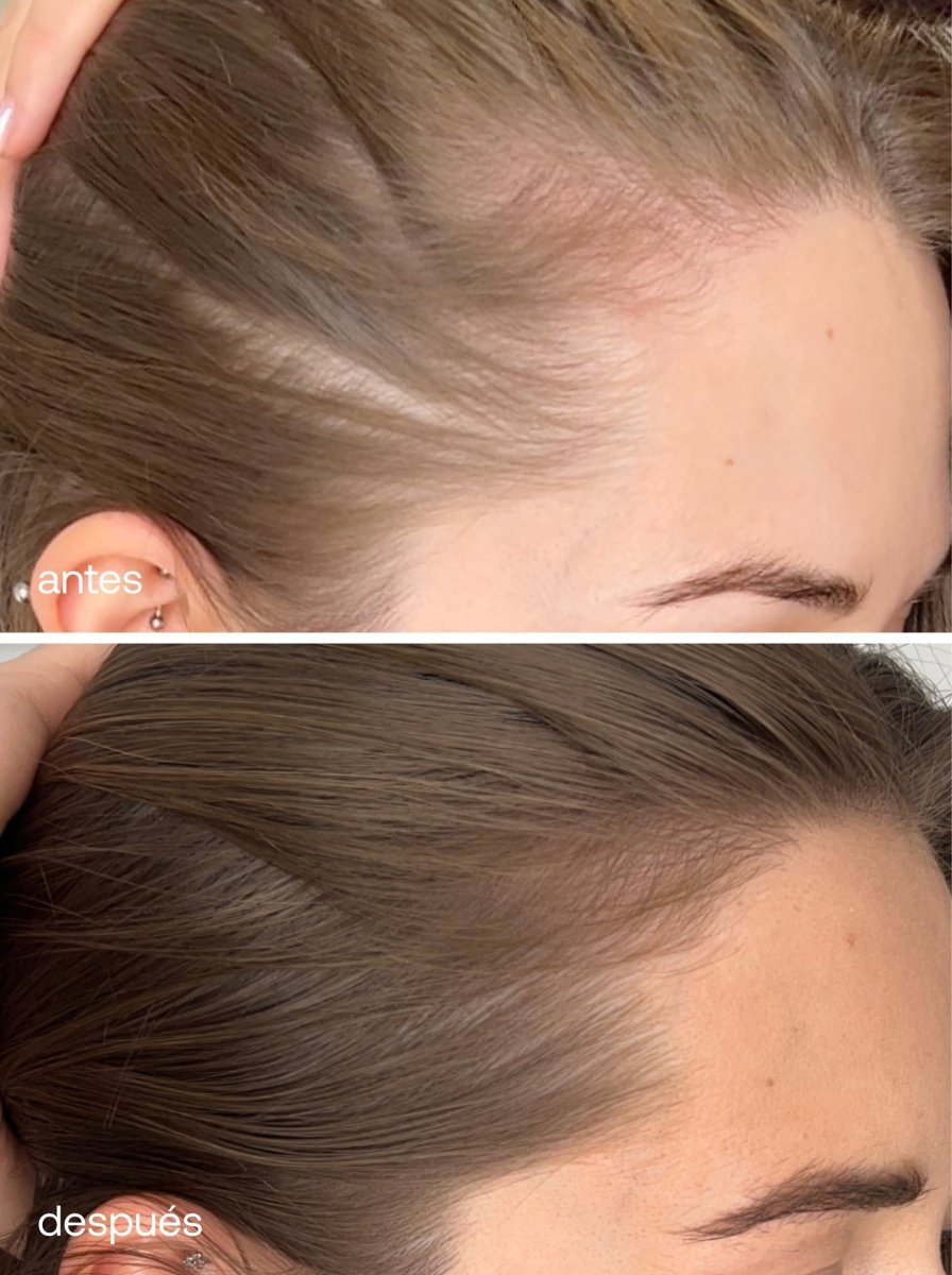 Suplementos Capilares Avanzados - UKLASH España